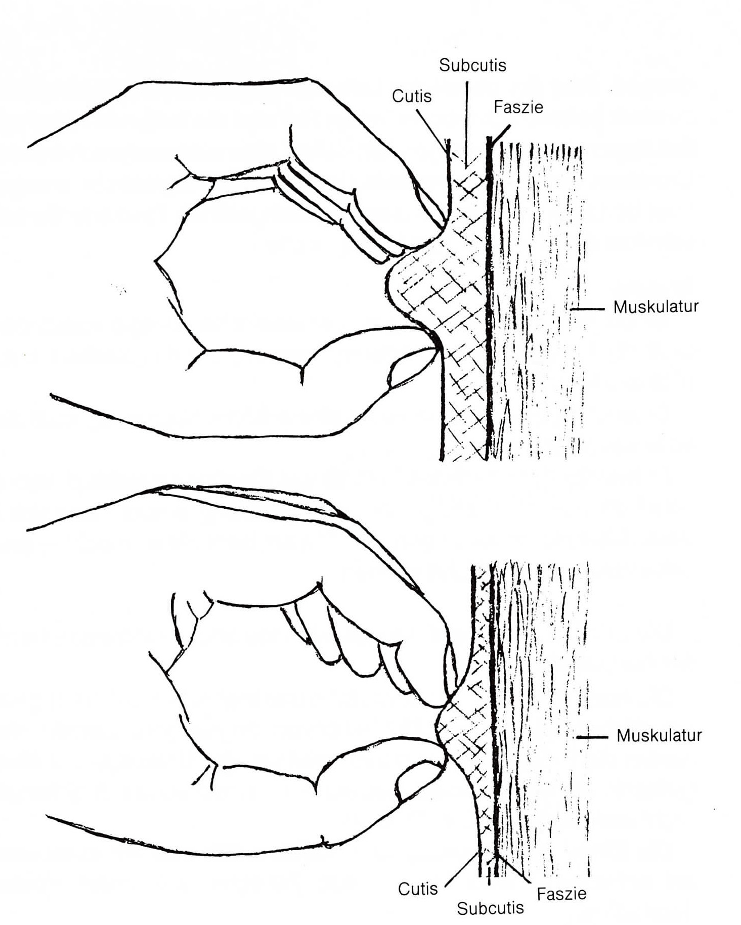 Kinesiologie Bild Bindegewebstest